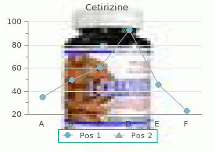 buy 5 mg cetirizine mastercard