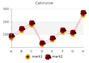 5 mg cetirizine fast delivery