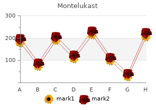 order montelukast 5mg amex