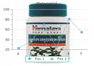 cheap 50 mg metoprolol mastercard