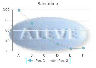 quality 150 mg ranitidine