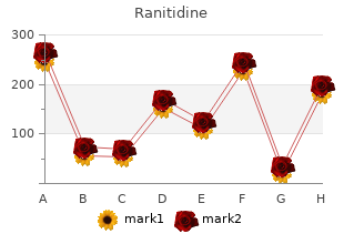 purchase ranitidine 150 mg