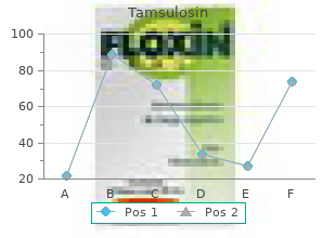 trusted tamsulosin 0.2 mg