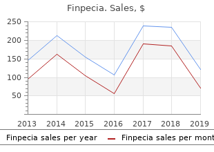 order 1mg finpecia amex