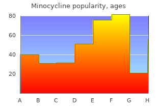 generic 50 mg minocycline mastercard