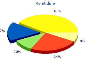 ranitidine 150 mg with amex