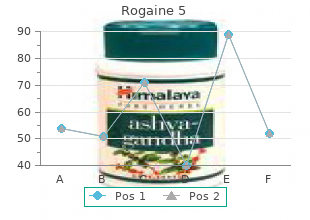 buy rogaine 5 60 ml free shipping