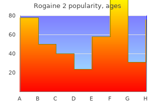 buy rogaine 2 60 ml lowest price