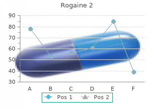 generic rogaine 2 60  ml without prescription