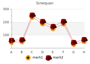 cheap sinequan 25mg otc