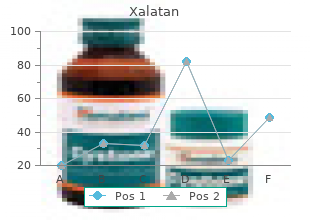 cheap xalatan 2.5  ml fast delivery