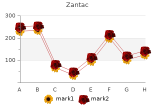 discount zantac 300 mg with mastercard