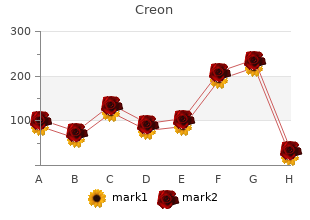 creon 150 mg discount